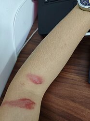 患处图片，谨慎点击